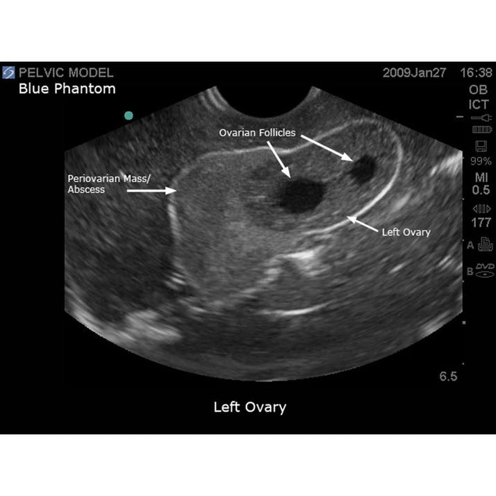 General Pathology Transvaginal Ultrasound Training Model - Sim & Skills