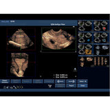 General Pathology Transvaginal Ultrasound Training Model BPOB1220 | Sim & Skills