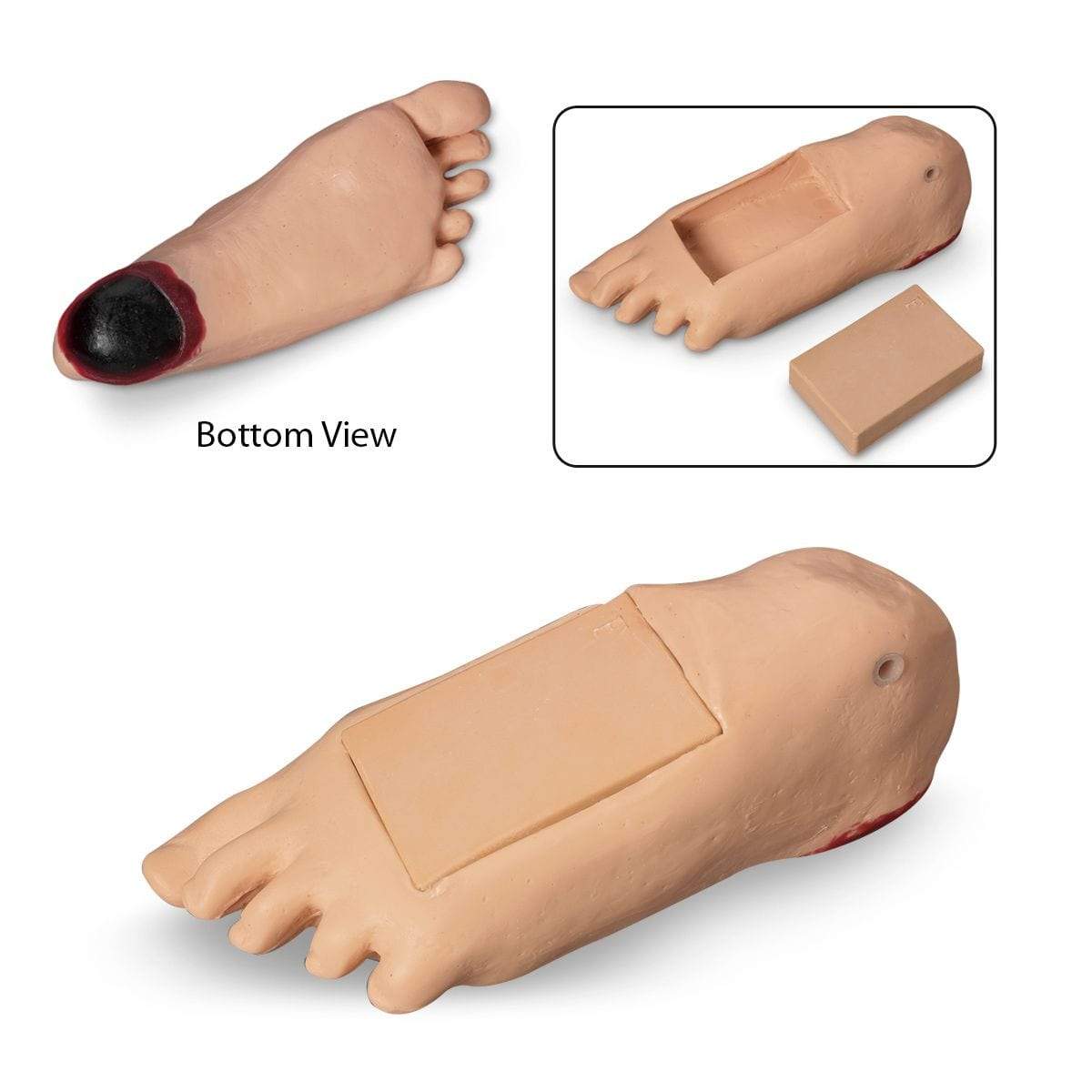 GERi/KERi - Oedema Foot with Deep Tissue Injury LF04084 | Sim & Skills