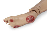 GERi/KERi Pressure Injury Foot LF04041 | Sim & Skills
