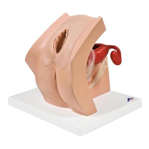 Gynaecological Contraceptive Device & Pessary Training Model 1013705 | Sim & Skills