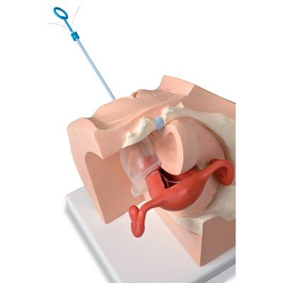 Gynaecological Contraceptive Device & Pessary Training Model 1013705 | Sim & Skills