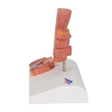 Haemorrhoid Model - 3B Smart Anatomy 1000315 | Sim & Skills