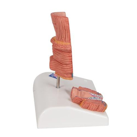 Haemorrhoid Model - 3B Smart Anatomy 1000315 | Sim & Skills