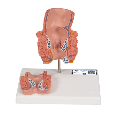 Haemorrhoid Model - 3B Smart Anatomy 1000315 | Sim & Skills