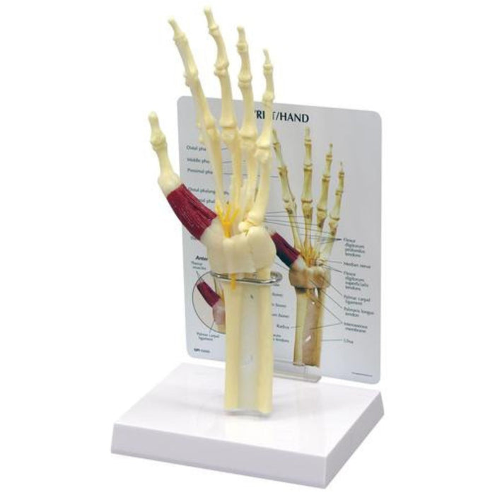 Hand/Wrist Carpal Tunnel Syndrome Model 1019519 | Sim & Skills