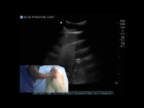 FAST Exam Ultrasound Training Model