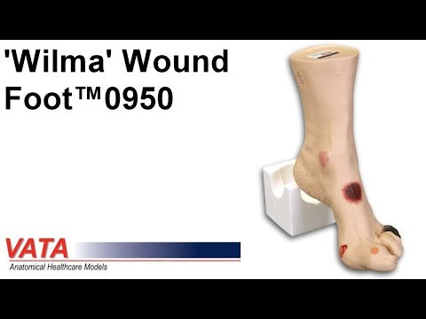 Wilma Wound Foot