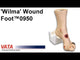 Wilma Wound Foot