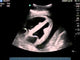 Transthoracic Echocardiography and Pericardiocentesis Ultrasound Training Model BP-TTE1701-H | Sim & Skills