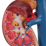 Human Kidneys Model with Rear Organs of Upper Abdomen, 3 part - 3B Smart Anatomy 1000310 | Sim & Skills