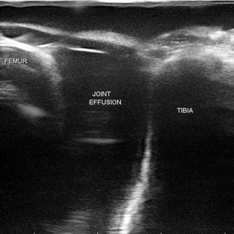 Knee Aspiration & Injection Ultrasound Training Model BPMSK-1000 | Sim & Skills