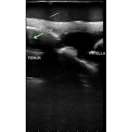 Knee Aspiration & Injection Ultrasound Training Model BPMSK-1000 | Sim & Skills