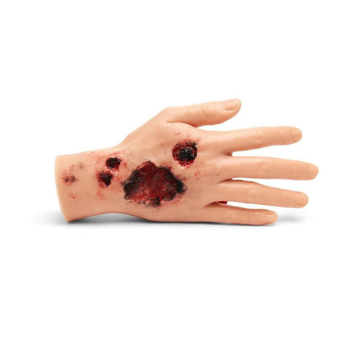 Large Adult Burned Hand M-MMBP-001-B | Sim & Skills