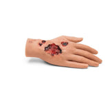 Large Adult Burned Hand M-MMBP-001-M | Sim & Skills