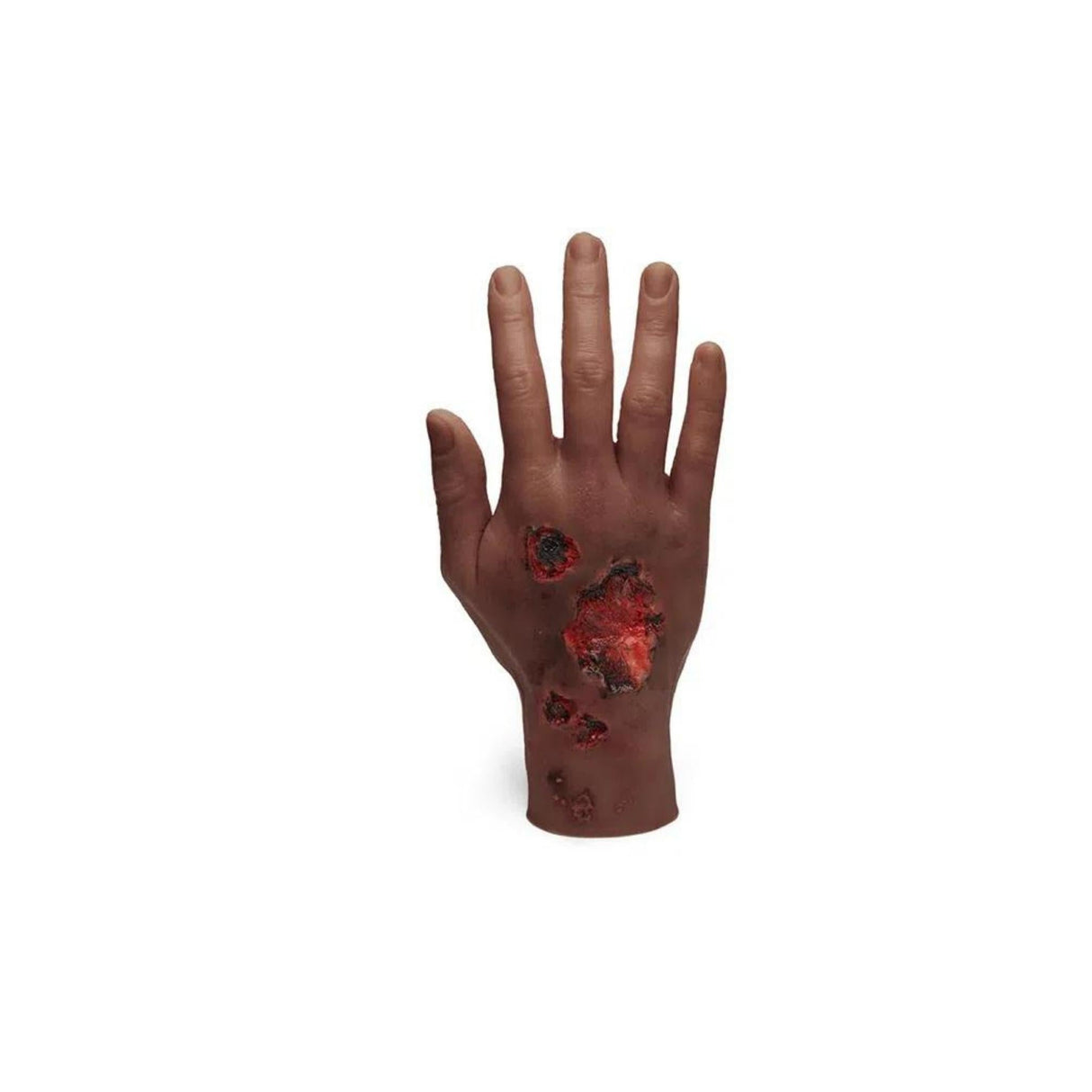 Large Adult Burned Hand M-MMBP-001-N | Sim & Skills