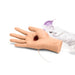 Large Adult Hand with Wound M-MMT-001-BL-B | Sim & Skills
