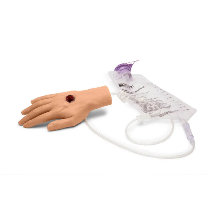 Large Adult Hand with Wound M-MMT-001-BL-B | Sim & Skills