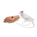 Large Adult Hand with Wound M-MMT-001-BL-M | Sim & Skills