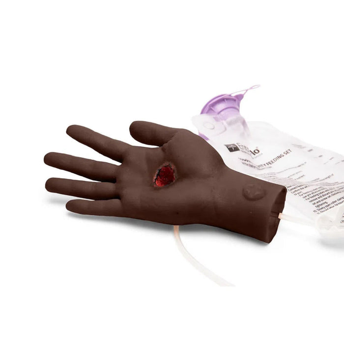 Large Adult Hand with Wound M-MMT-001-BL-N | Sim & Skills