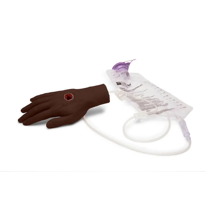 Large Adult Hand with Wound M-MMT-001-BL-N | Sim & Skills