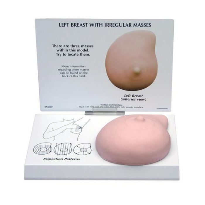 Left Breast Model with Irregular Masses 1019558 | Sim & Skills
