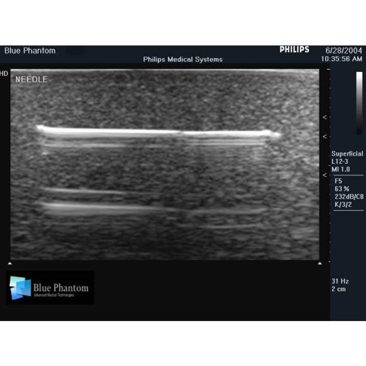 Leg Model with Foreign Body Identification Insert For Ultrasound Training BPL550 | Sim & Skills