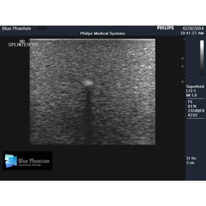 Leg Model with Foreign Body Identification Insert For Ultrasound Training BPL550 | Sim & Skills