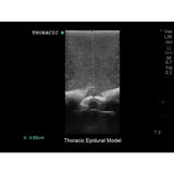 Lumbar Puncture and Spinal Epidural Ultrasound Training Model BPLP2101 | Sim & Skills