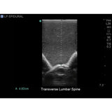 Lumbar Puncture and Spinal Epidural Ultrasound Training Model BPLP2101 | Sim & Skills