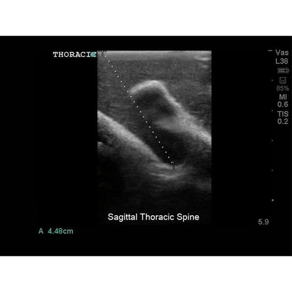 Lumbar Puncture and Spinal Epidural Ultrasound Training Model BPLP2101 | Sim & Skills