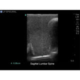 Lumbar Puncture and Spinal Epidural Ultrasound Training Model BPLP2101 | Sim & Skills