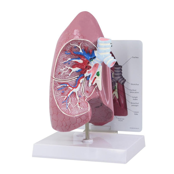Lung Model 1019545 | Sim & Skills