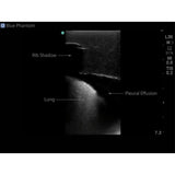 Midscapular Thoracentesis Ultrasound Training Model BPTT2-1005 | Sim & Skills