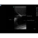 Midscapular Thoracentesis Ultrasound Training Model BPTT2-1005 | Sim & Skills