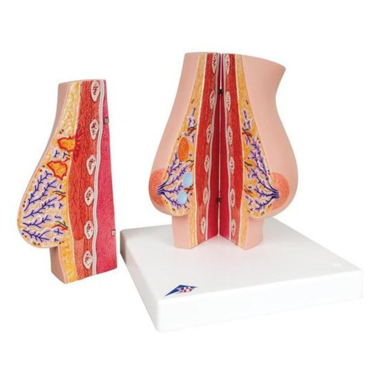 Model of Female Breast with Healthy & Unhealthy Tissue 1008497 | Sim & Skills