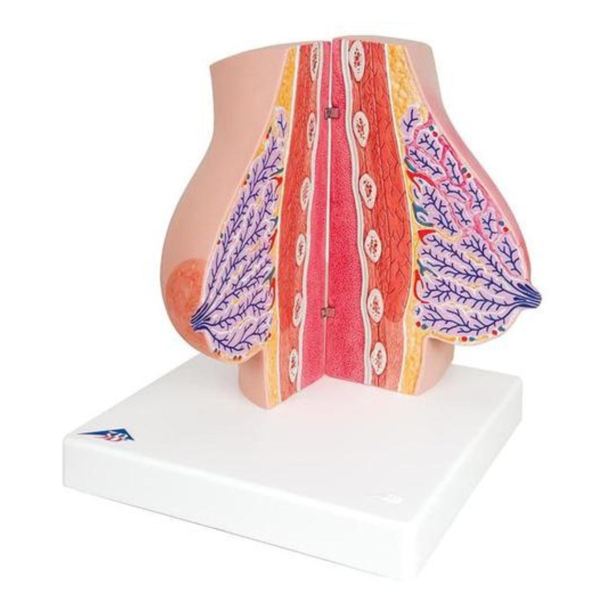 Model of Female Breast with Healthy & Unhealthy Tissue 1008497 | Sim & Skills