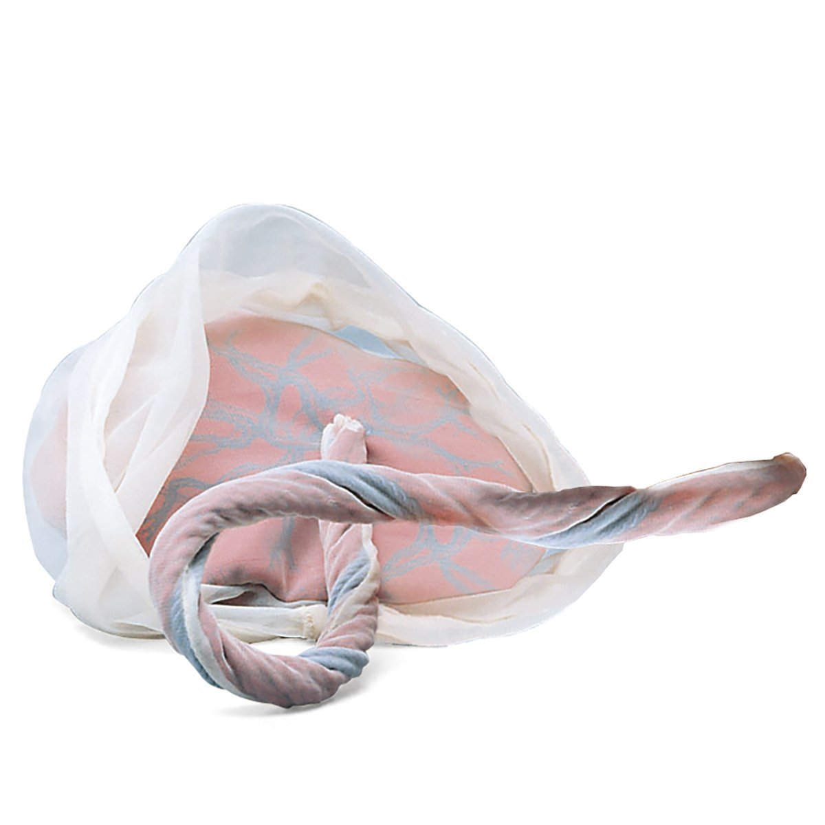 Model of Placenta & Umbilical Cord 1005573 | Sim & Skills