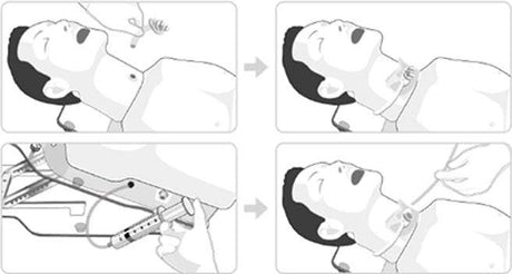 NG Tube Feeding, Tracheostomy Care & Suction Trainer BT-CSIS | Sim & Skills