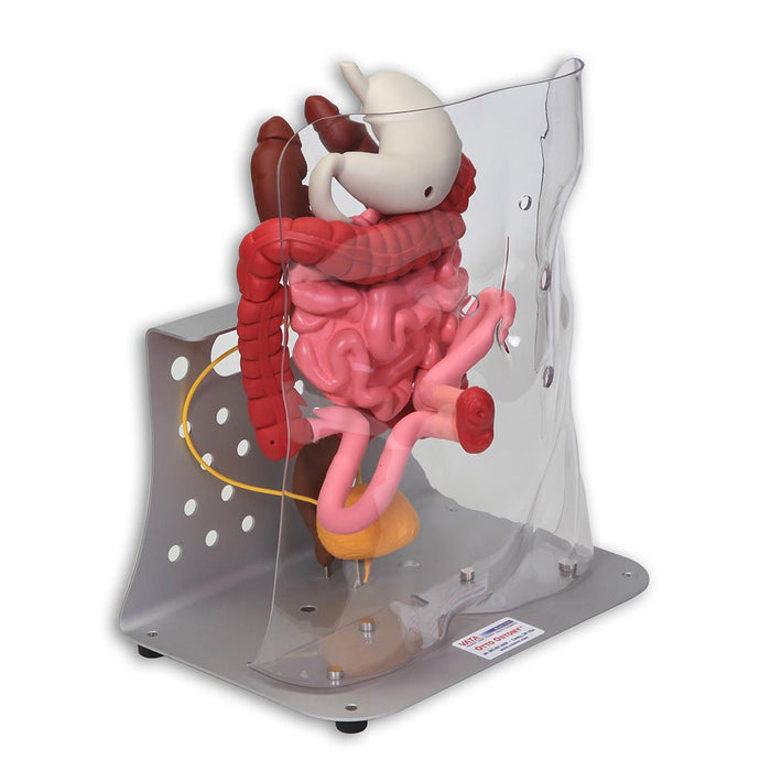 Otto Ostomy Anatomical Model VTA310 | Sim & Skills