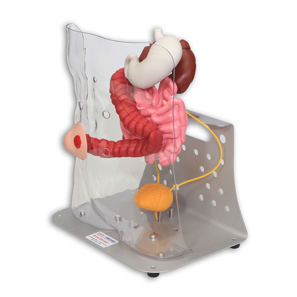 Otto Ostomy Anatomical Model VTA310 | Sim & Skills