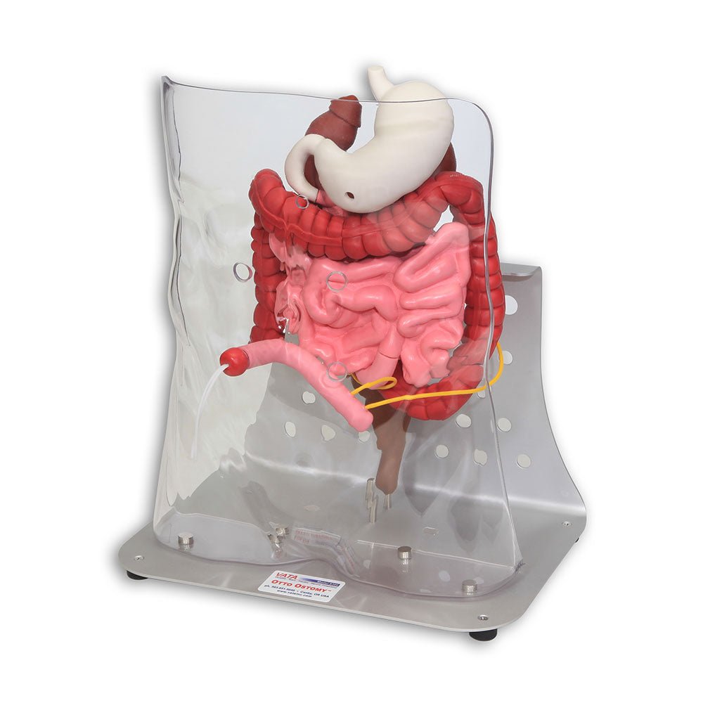 Otto Ostomy Anatomical Model VTA310 | Sim & Skills