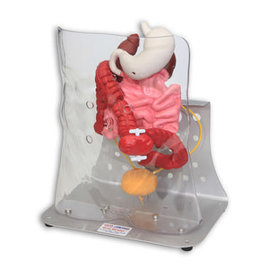 Otto Ostomy Anatomical Model