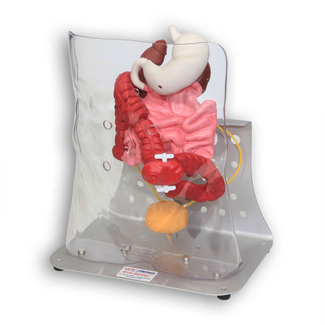 Otto Ostomy Anatomical Model VTA310 | Sim & Skills