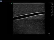 Paediatric Branched 4 Vessel Ultrasound Training Block Model BPP120 | Sim & Skills