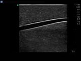 Paediatric Branched 4 Vessel Ultrasound Training Block Model BPP120 | Sim & Skills