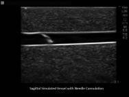 Paediatric Branched 4 Vessel Ultrasound Training Block Model BPP120 | Sim & Skills