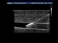 Paediatric Branched 4 Vessel Ultrasound Training Block Model BPP120 | Sim & Skills