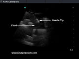 Paracentesis Ultrasound Replacement Tissue Insert BPPara1302 | Sim & Skills