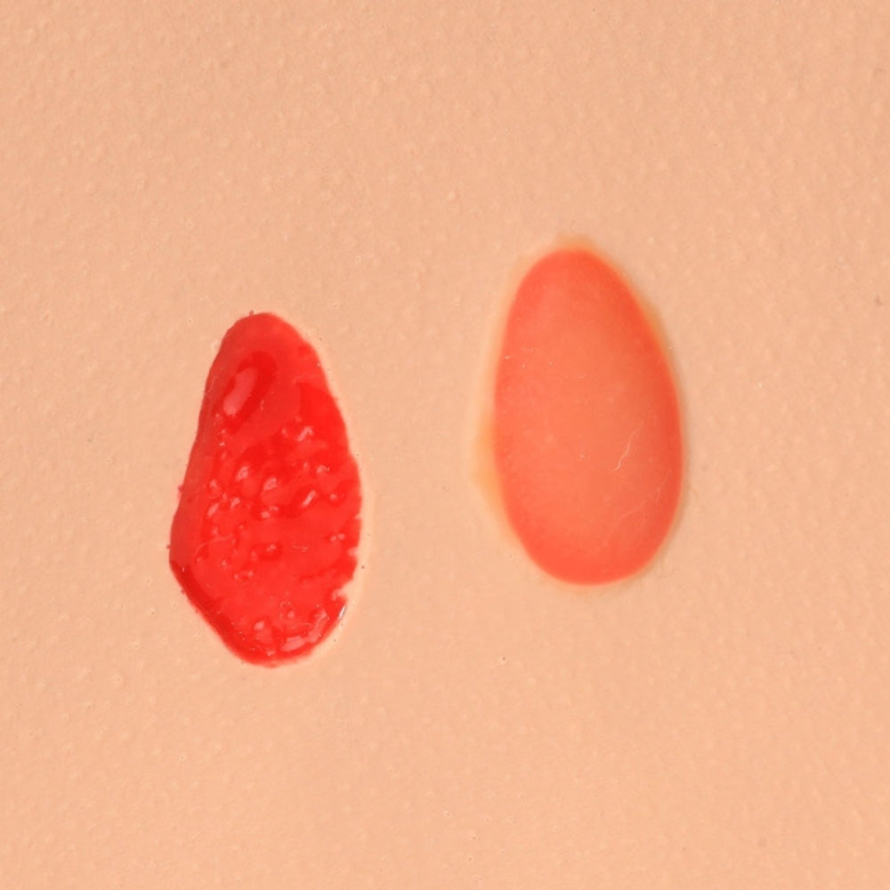 PAT Pressure Injury Staging Model VTA0980 | Sim & Skills